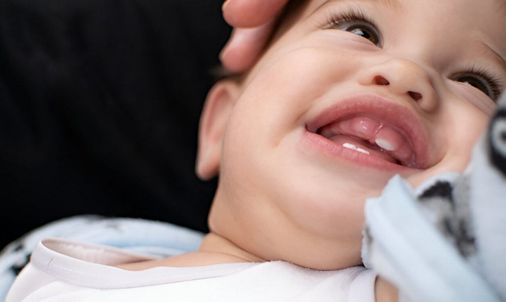 Are Canine Teeth Painful for Babies