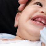 Are Canine Teeth Painful for Babies