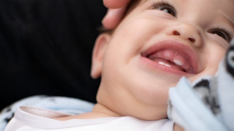 Are Canine Teeth Painful for Babies?