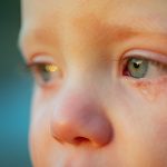 Why Are My Baby's Eyes Watering?